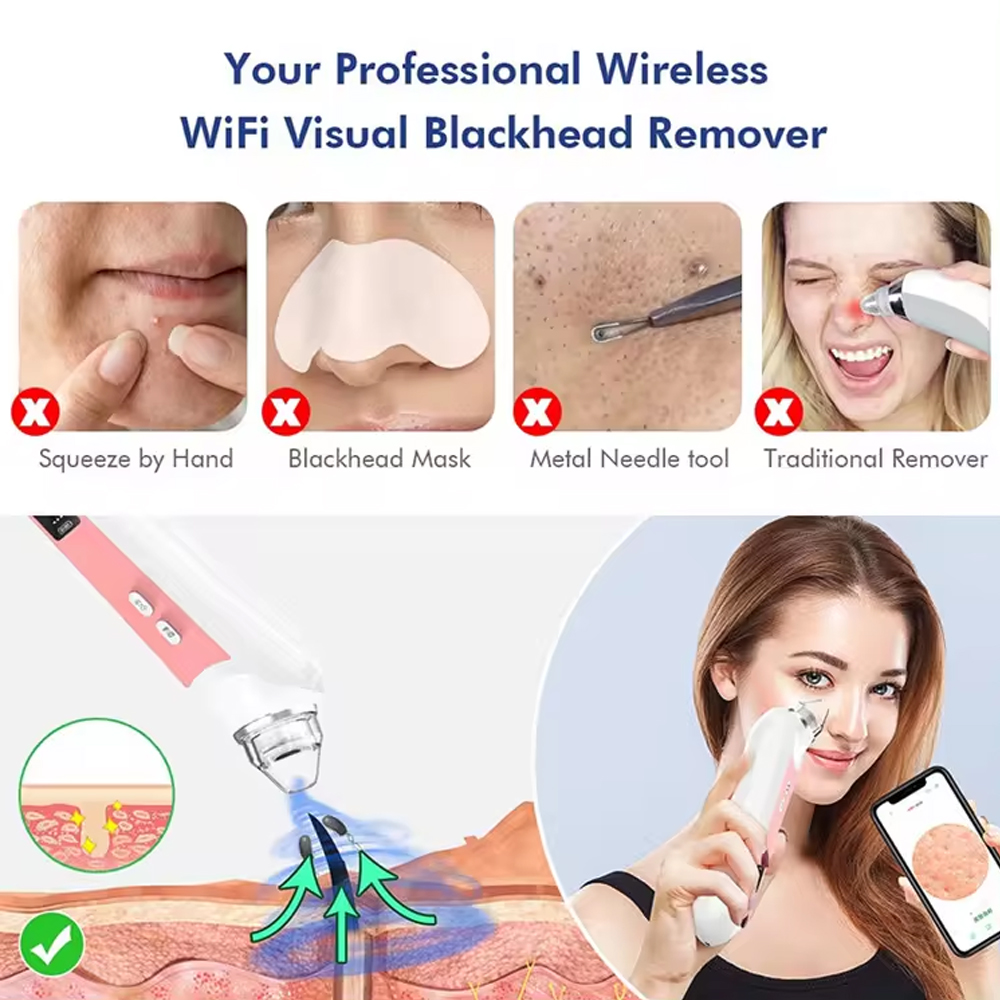 6 Heads Pore Cleaner Blackhead - огляд і ціна Nasal Aspirator