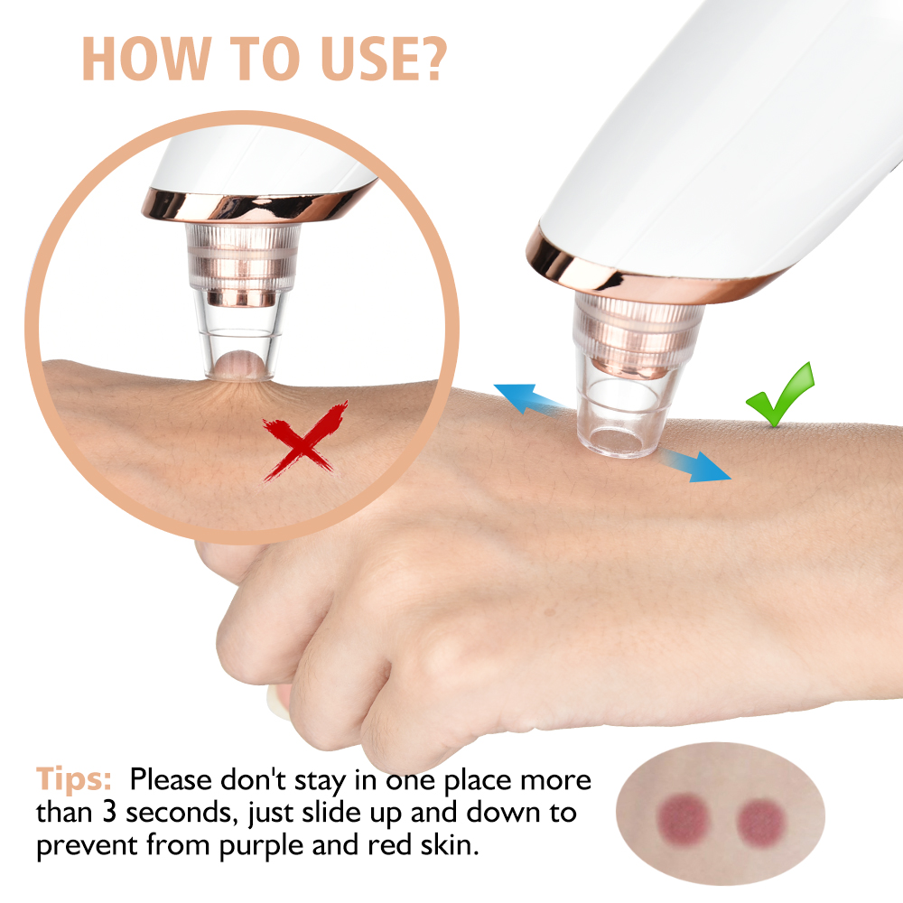 Blackhead Remover Vacuum Pore  - огляд і ціна Nasal Aspirator
